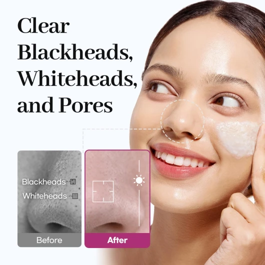 71mhHsx2iFL._SL1500_