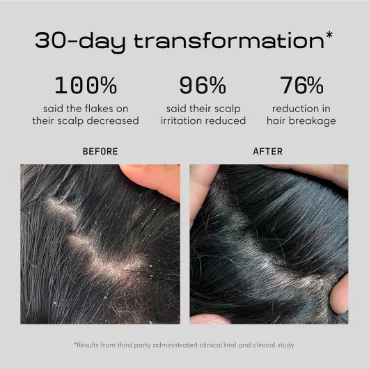 81KnIuTcWiL._SL1500_