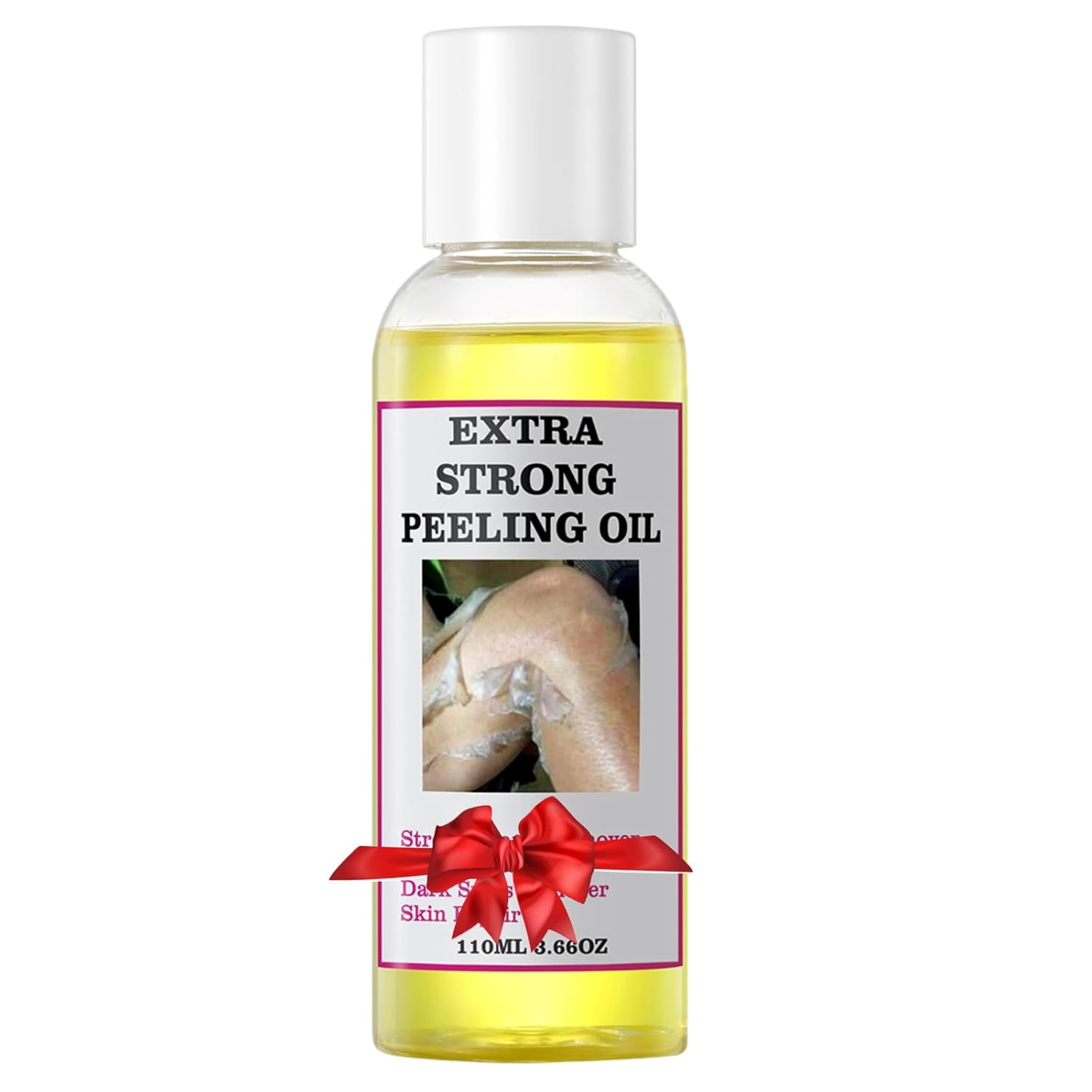 Yellow Peeling Oil for Dark Skin Strong Peel Oil Extra Strength Exfoliating Chemical Exfoliant Peels Solution at Home Body Peeling for Exfoliate Body Hand Foot Knuckle All Skin Type 3.66 OZ 3.7 Fl Oz (Pack of 1) Yellow