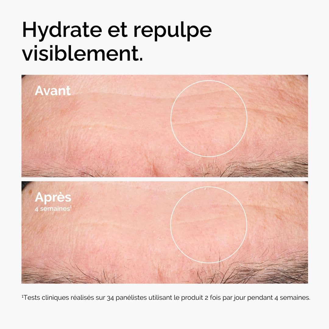 The Ordinary Acide Hyaluronique 2% + B5 (à base de Céramides), Sérum hydratant en profondeur pour une peau plus ferme et lisse, 30 ml