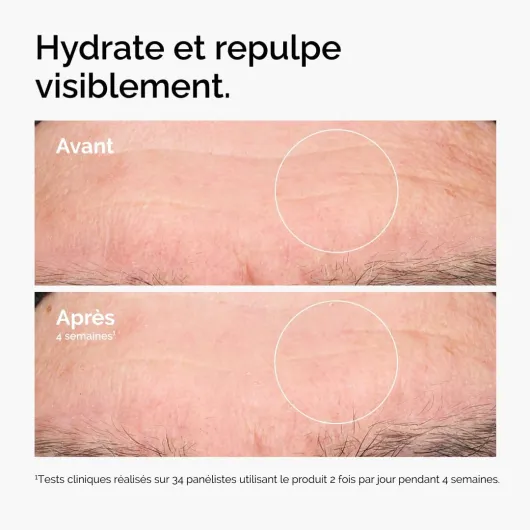The Ordinary Acide Hyaluronique 2% + B5 (à base de Céramides), Sérum hydratant en profondeur pour une peau plus ferme et lisse, 30 ml